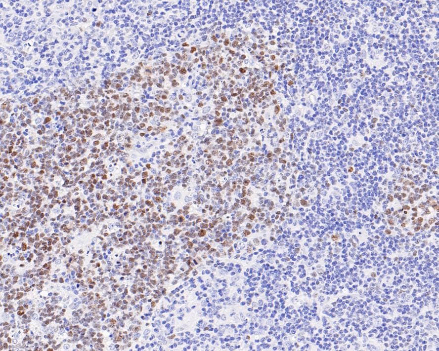 Bcl-6 Antibody (A6C8-R)