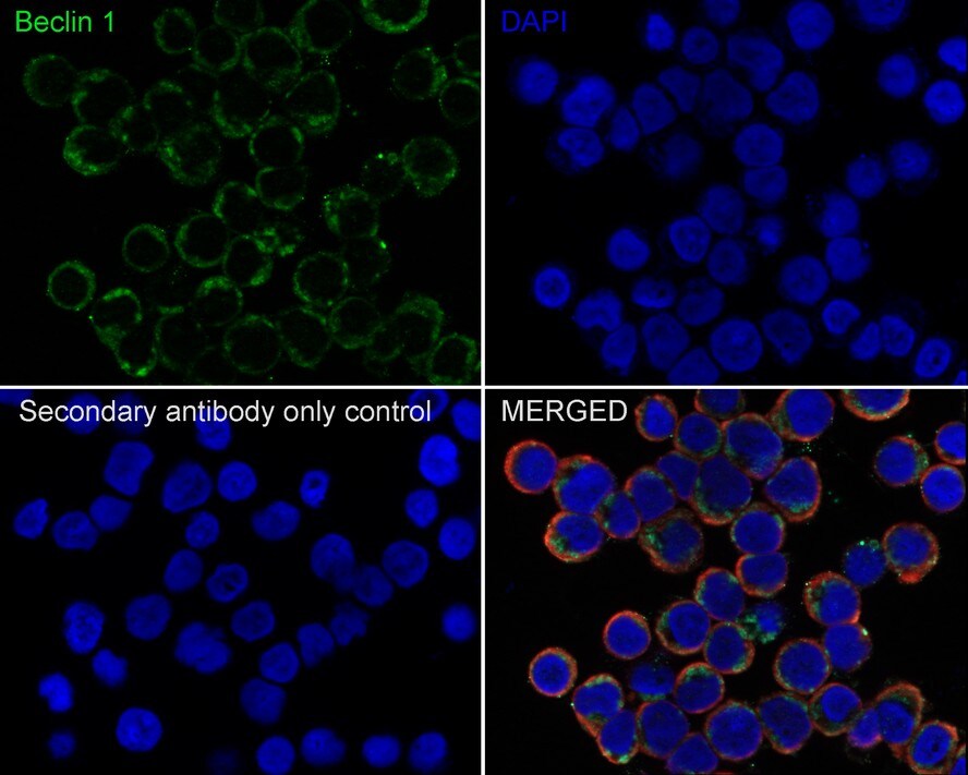 Beclin 1 Antibody (JE59-31)