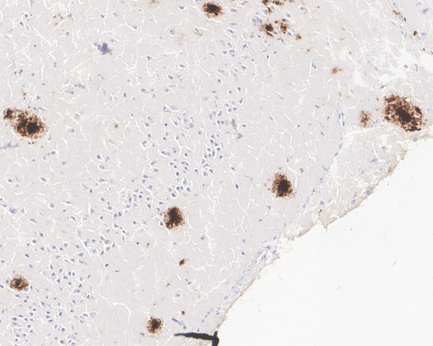 Abeta 42 Antibody (PSH02-83)