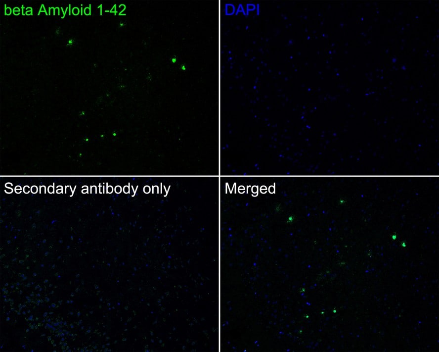 Abeta 42 Antibody (PSH02-83)