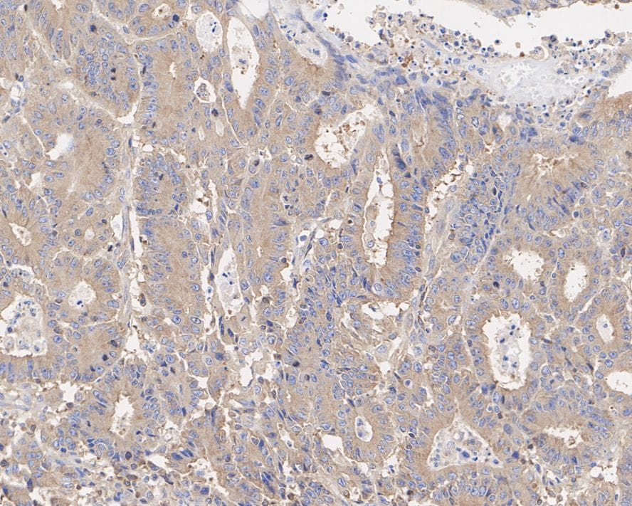 beta Tubulin Antibody (A1-A4-R)