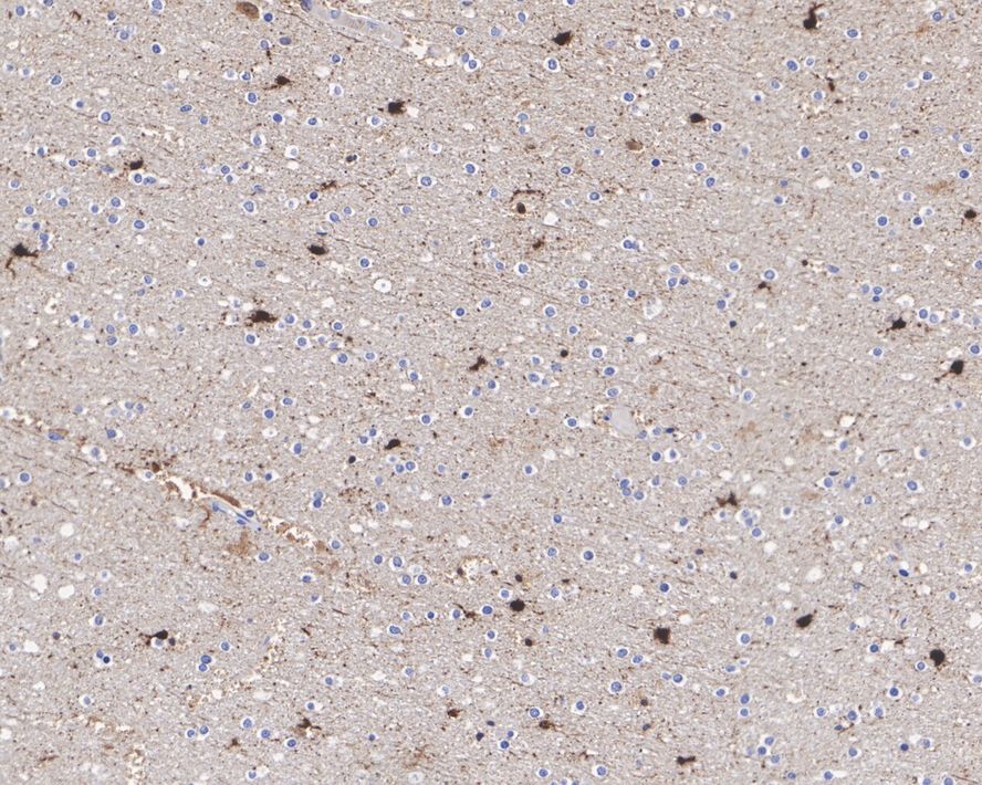 FABP7/B-FABP Antibody (PSH0-89)