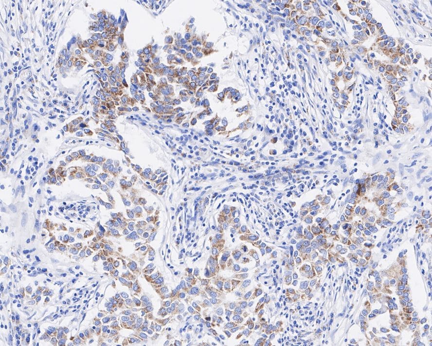 BMP-4 Antibody (JE42-44)