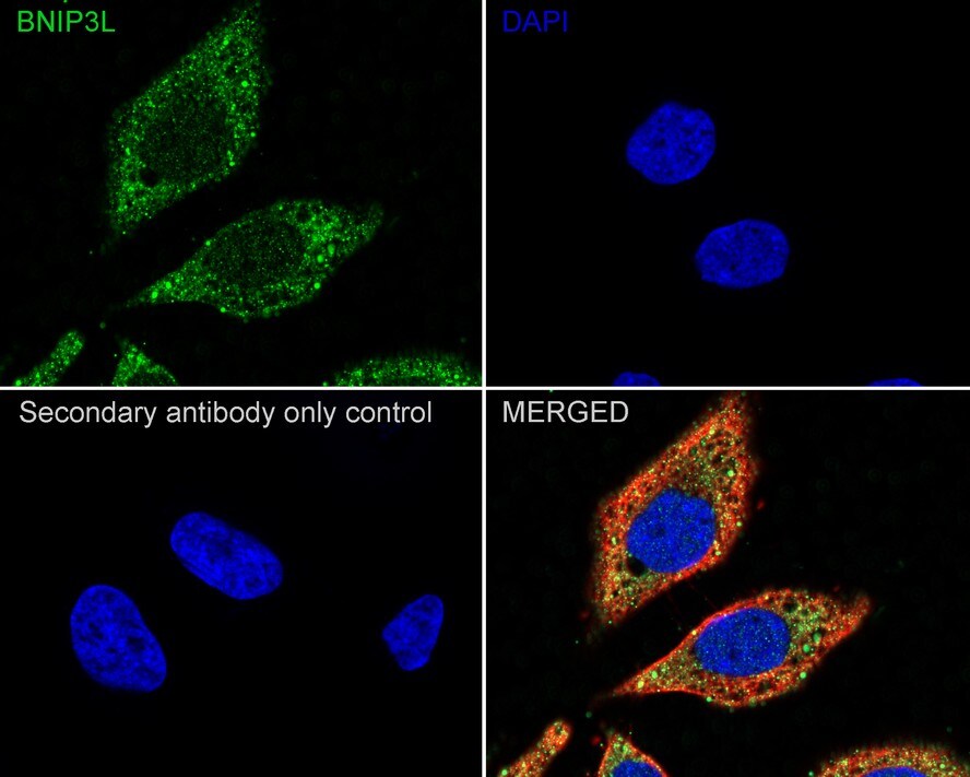 BNIP3L Antibody (JE59-98)