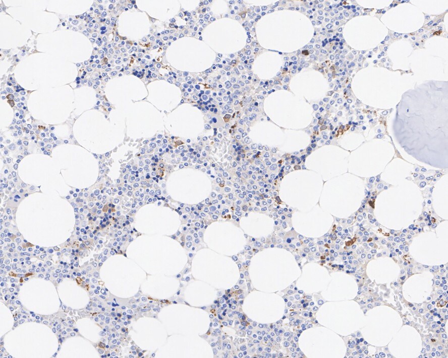 BNIP3L Antibody (JE59-98)