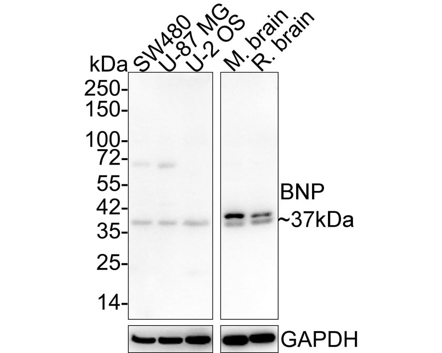 BNP Antibody (JE30-94) Western Blot: BNP Antibody (JE30-94) [NBP3-32088]
