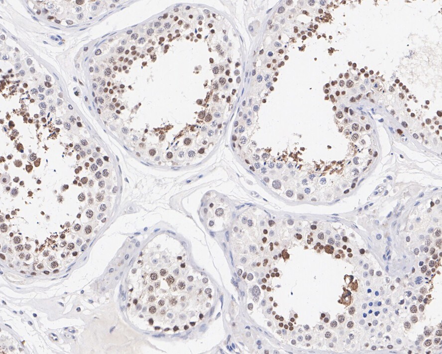 SPEM2 Antibody (PSH02-66)