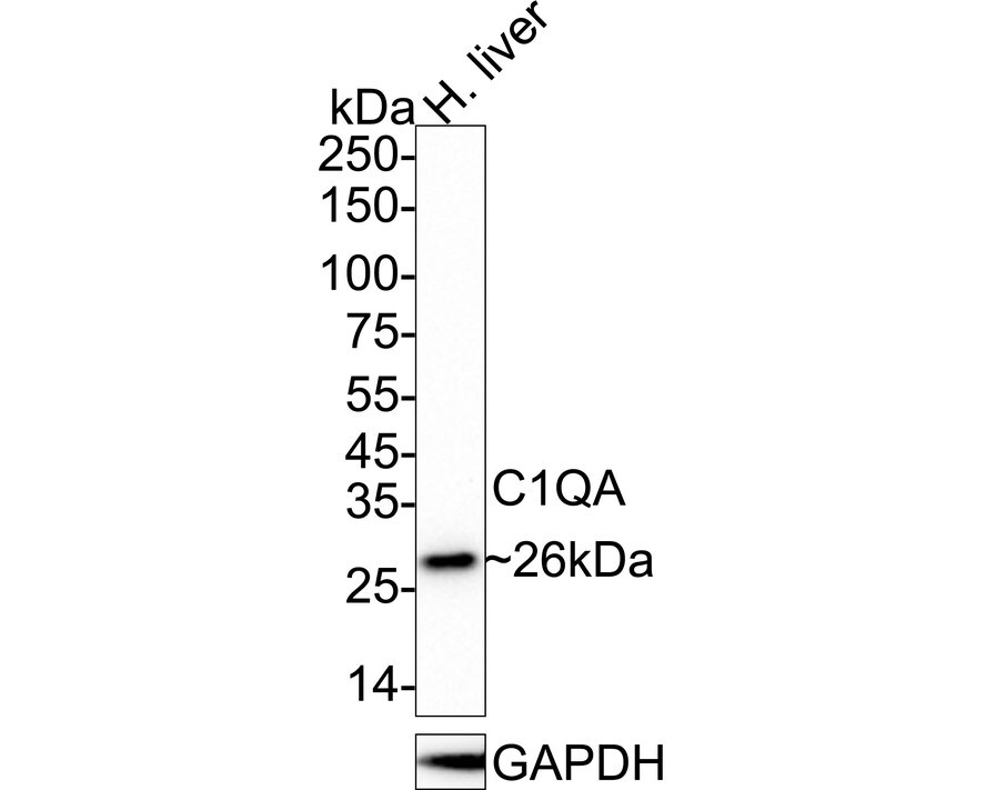 Complement Component C1qA Antibody (JE66-59) Western Blot: Complement Component C1qA Antibody (JE66-59) [NBP3-32097]