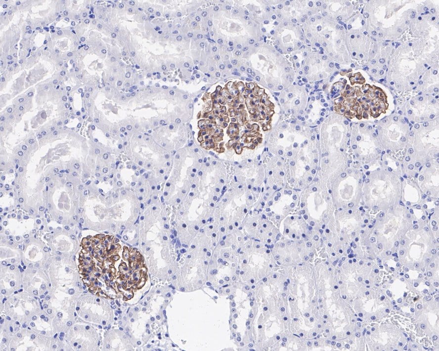 Complement Component C1qA Antibody (JE66-59)