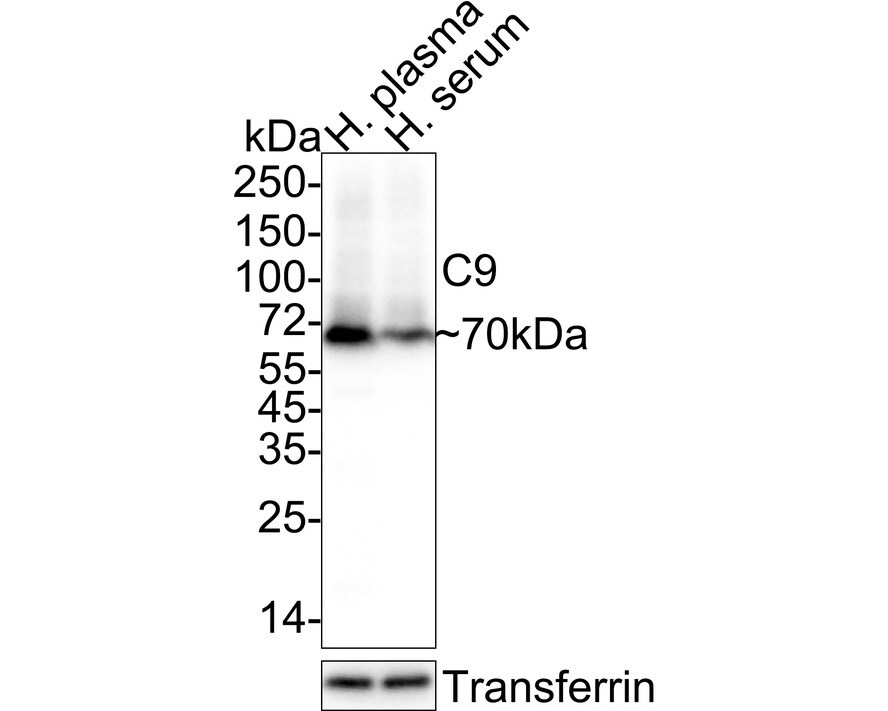 Complement Component C9 Antibody (JE01-45) Western Blot: Complement Component C9 Antibody (JE01-45) [NBP3-32098]