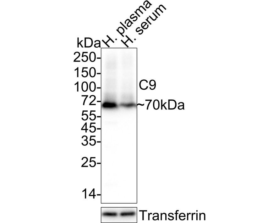 Complement Component C9 Antibody (JE01-45)