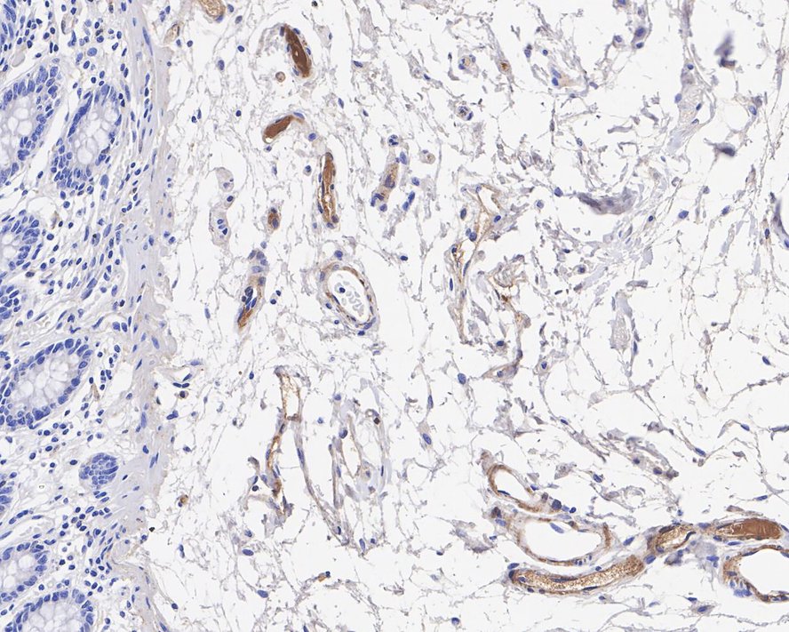 Complement Component C9 Antibody (JE01-45)