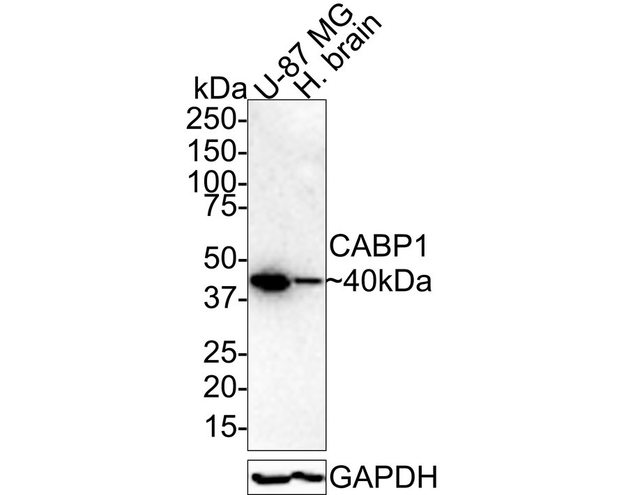 CABP1 Antibody (JE56-72)