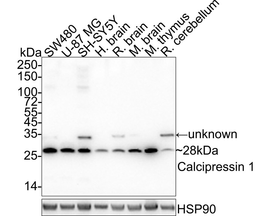 RCAN1 Antibody (JE62-71) Western Blot: RCAN1 Antibody (JE62-71) [NBP3-32100]