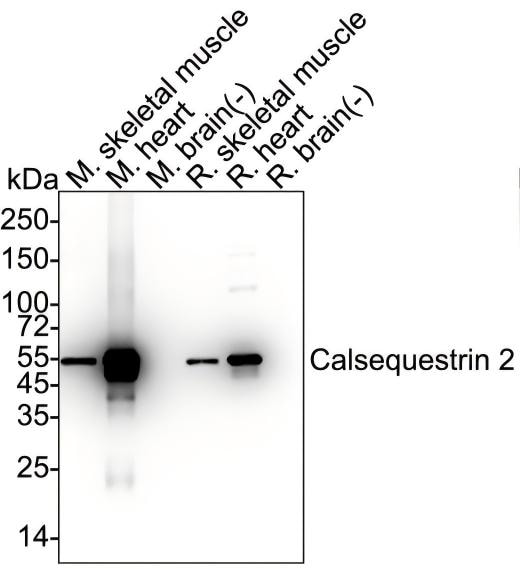 Calsequestrin 2 Antibody (PSH03-16) Western Blot: Calsequestrin 2 Antibody (PSH03-16) [NBP3-32102]