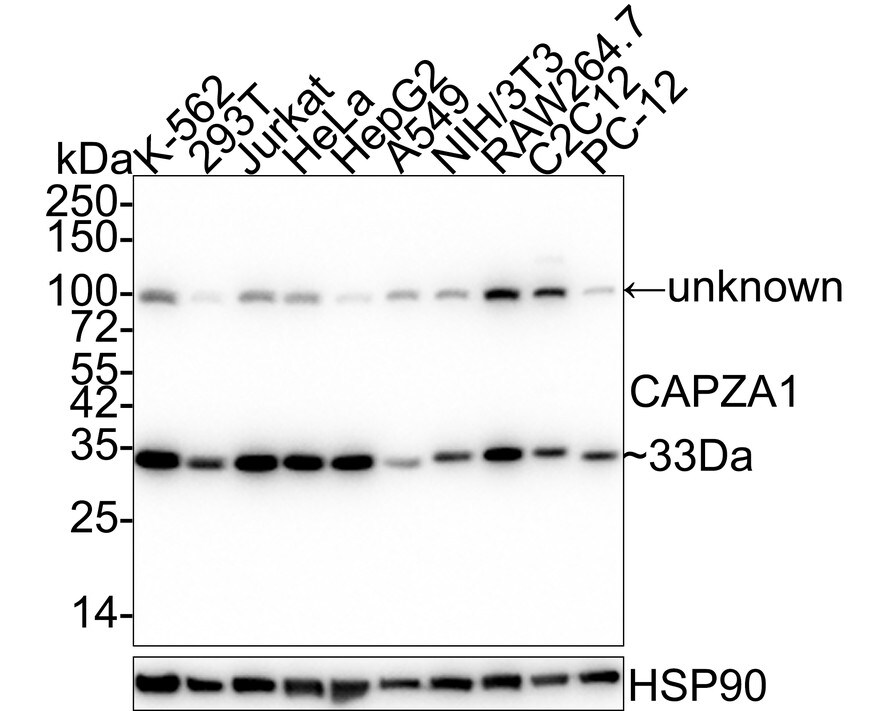 CAPZA1 Antibody (A2E7-R) Western Blot: CAPZA1 Antibody (A2E7-R) [NBP3-32104]