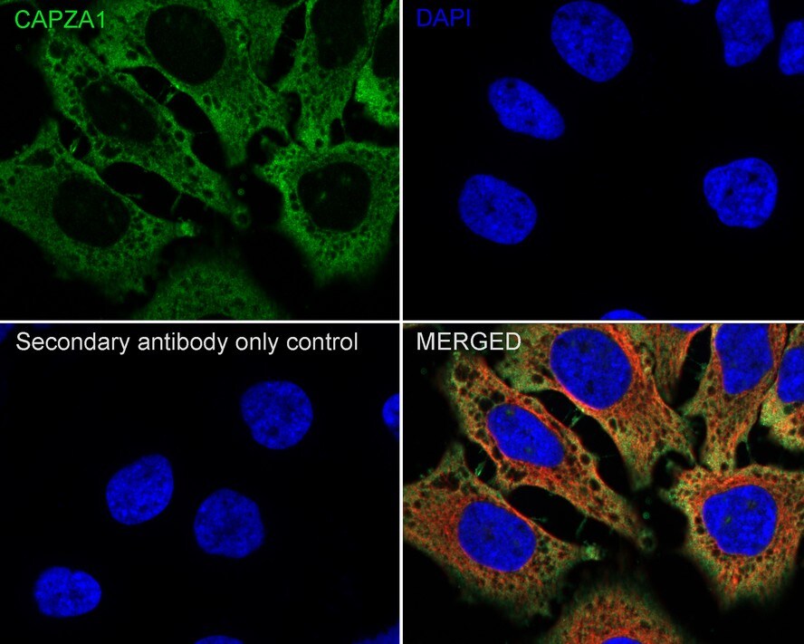 CAPZA1 Antibody (A2E7-R)