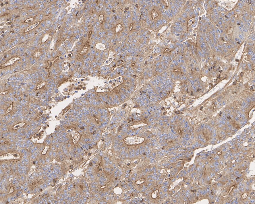 CAPZA1 Antibody (A2E7-R)