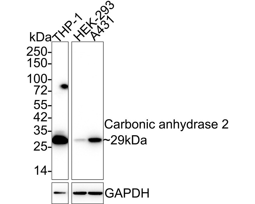 Carbonic Anhydrase II/CA2 Antibody (11A2-R) Western Blot: Carbonic Anhydrase II/CA2 Antibody (11A2-R) [NBP3-32105]