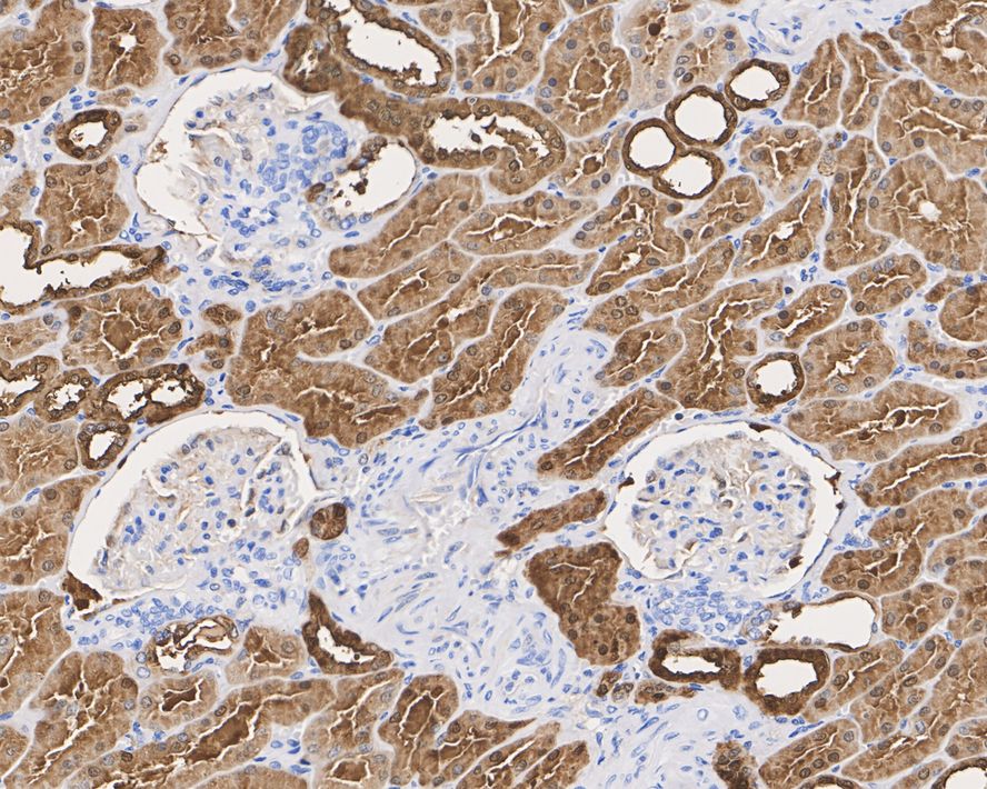 Carbonic Anhydrase II/CA2 Antibody (11A2-R)