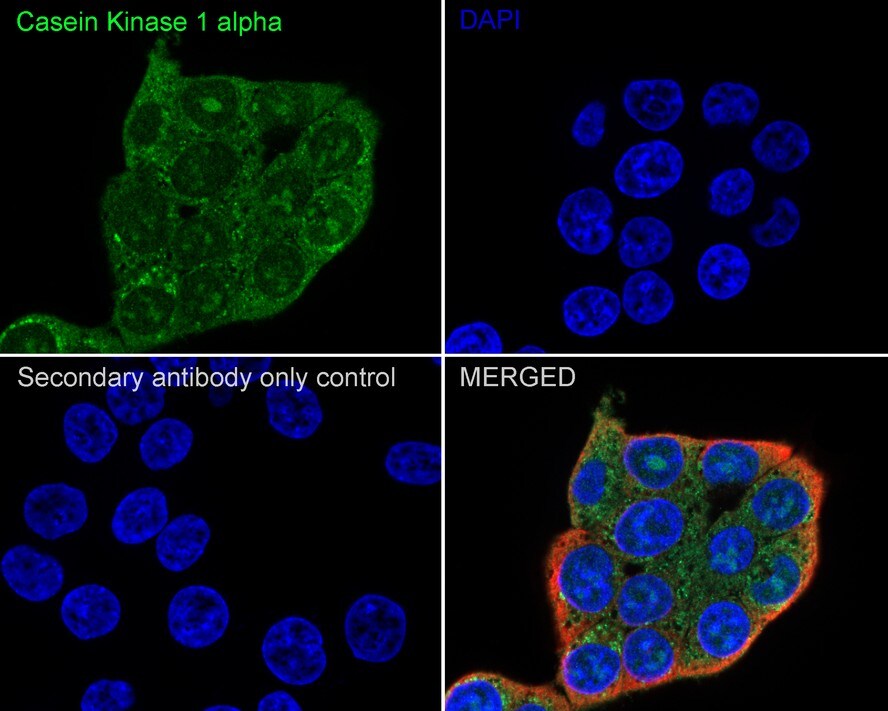 Casein Kinase 1 alpha Antibody (PSH04-46)