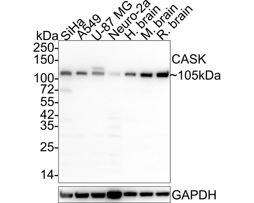 CASK Antibody (A1C5-R) Western Blot: CASK Antibody (A1C5-R) [NBP3-32108]