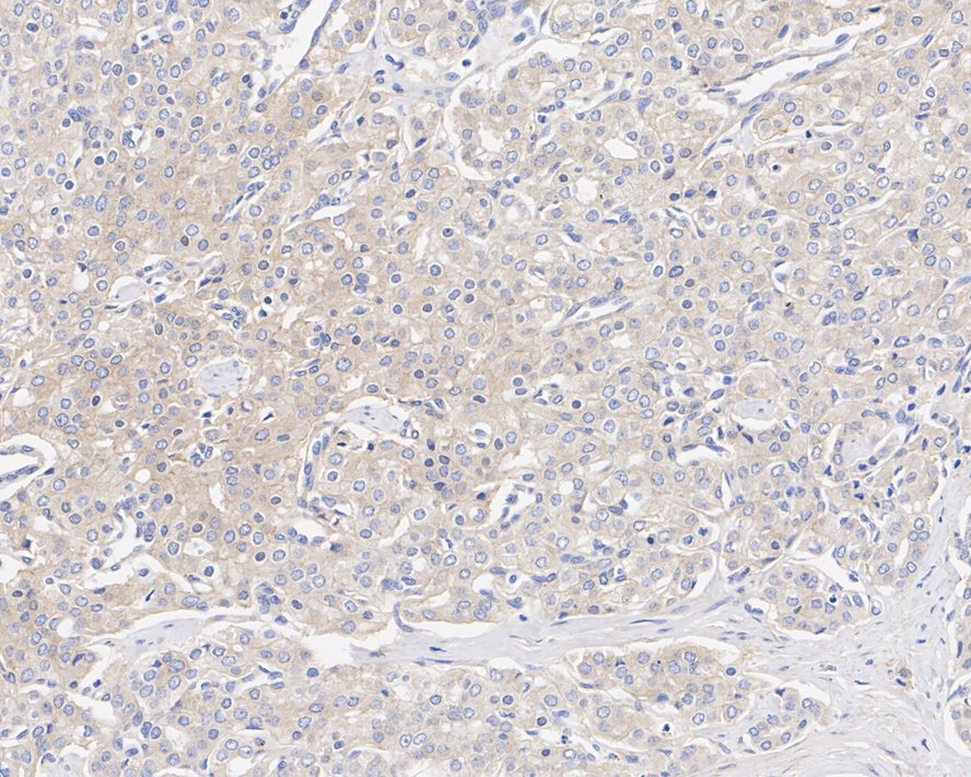 CASK Antibody (A1C5-R)