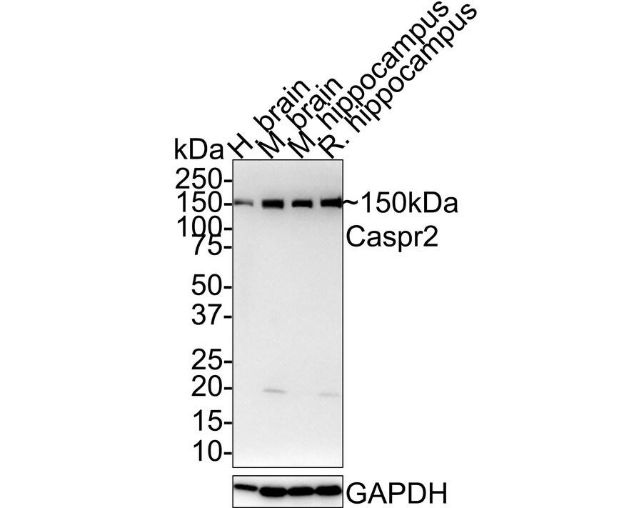 Caspr2 Antibody (JE41-03) Western Blot: Caspr2 Antibody (JE41-03) [NBP3-32110]