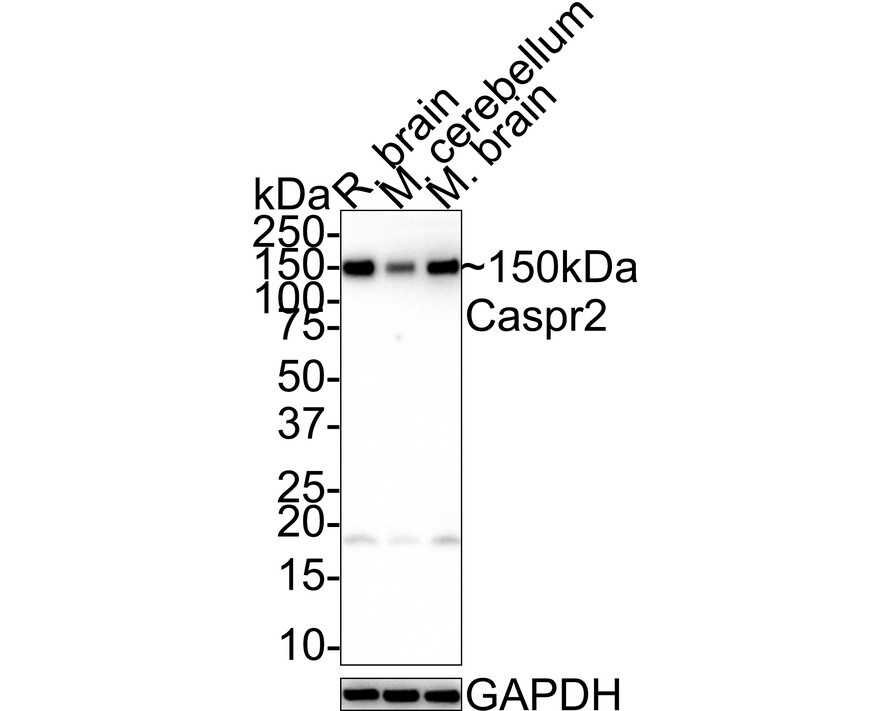 Caspr2 Antibody (JE41-03) Western Blot: Caspr2 Antibody (JE41-03) [NBP3-32110]