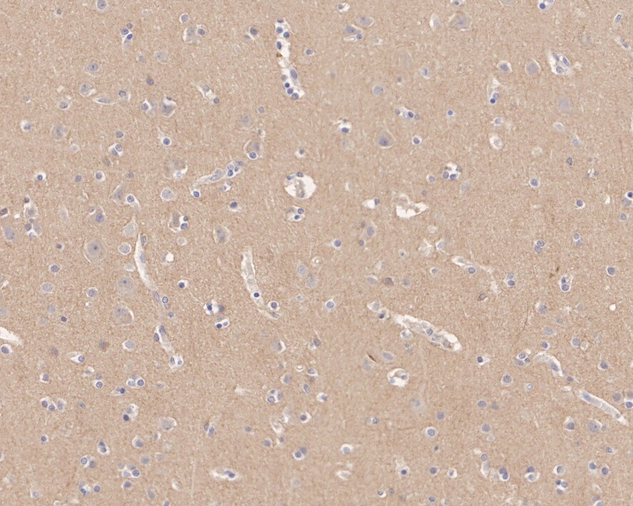 Caspr2 Antibody (JE41-03)