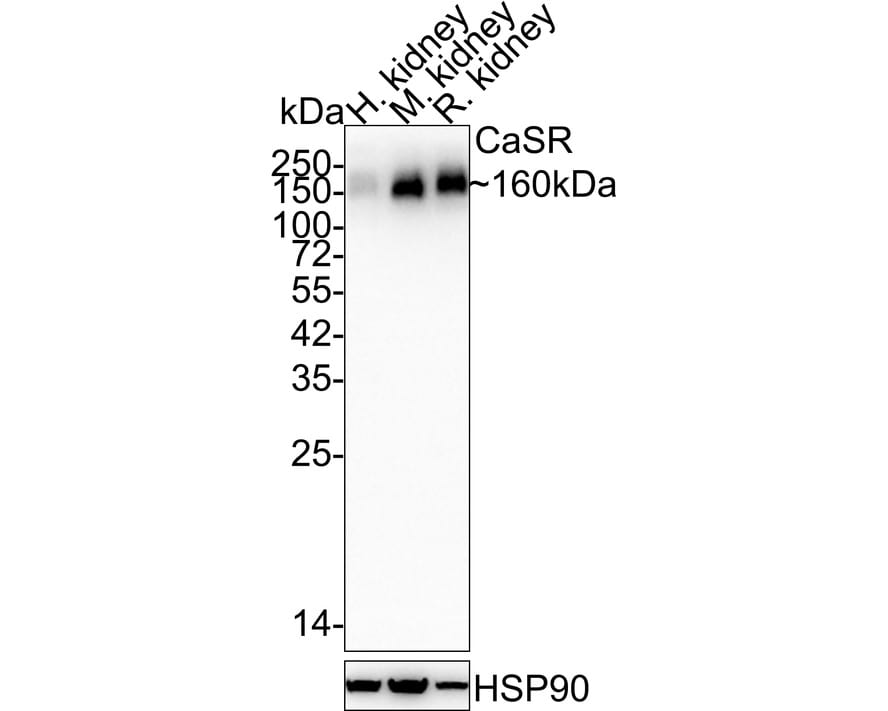 Calcium-sensing R/CaSR Antibody (PSH03-47) Western Blot: Calcium-sensing R/CaSR Antibody (PSH03-47) [NBP3-32111]