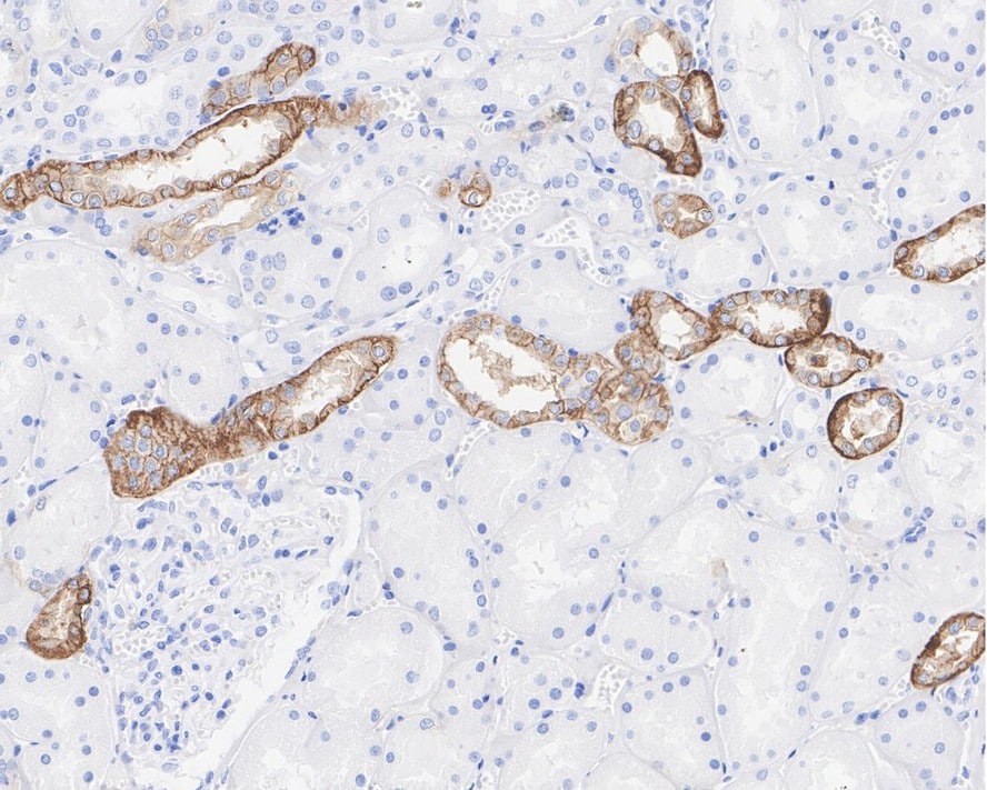 Calcium-sensing R/CaSR Antibody (PSH03-47)