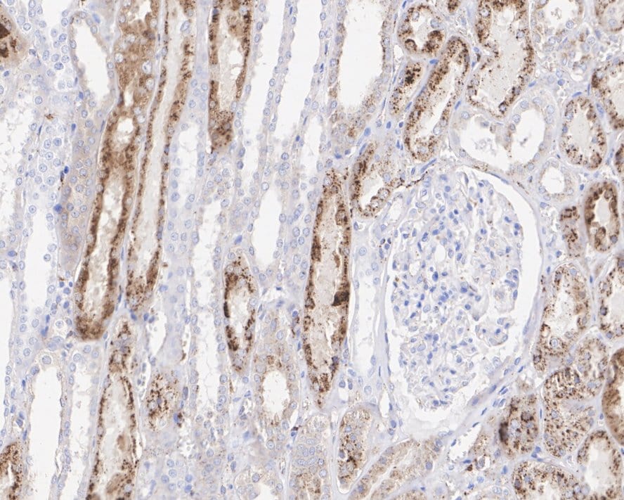 Cathepsin L Antibody (PSH03-92)