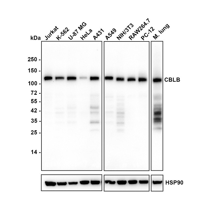 CBLB Antibody (PSH03-49) Western Blot: CBLB Antibody (PSH03-49) [NBP3-32113]