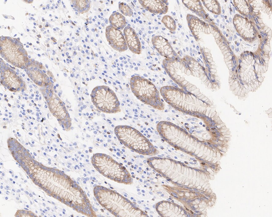 CBLB Antibody (PSH03-49)