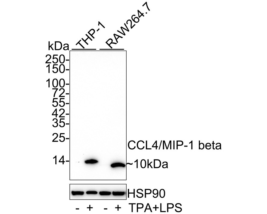 CCL4/MIP-1 beta Antibody (JE33-21)