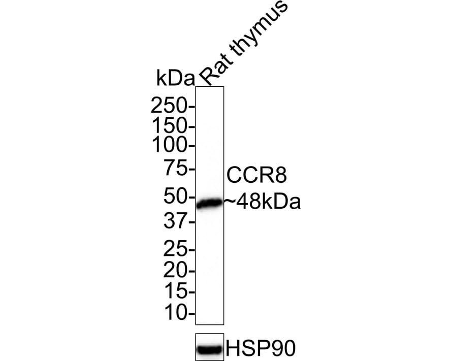 CCR8 Antibody (JE31-99) Western Blot: CCR8 Antibody (JE31-99) [NBP3-32117]