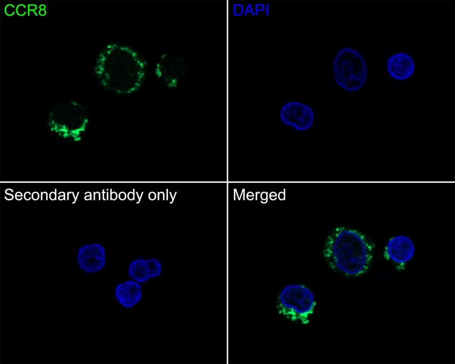 CCR8 Antibody (JE31-99)