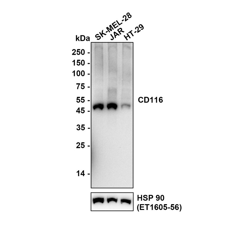 GM-CSFR alpha Antibody (JE61-37) Western Blot: GM-CSFR alpha Antibody (JE61-37) [NBP3-32120]