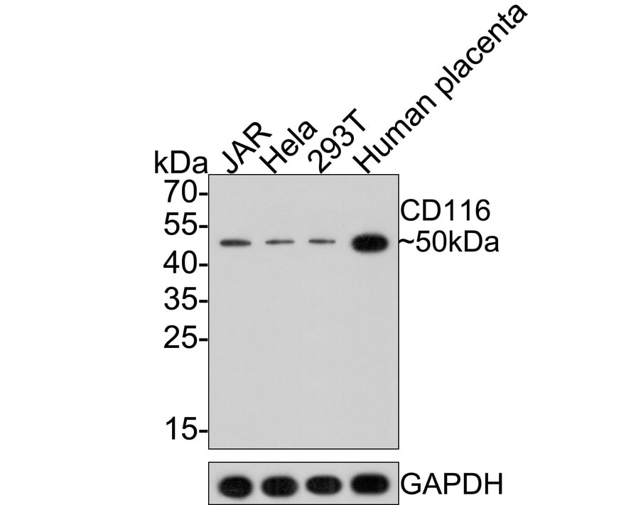 GM-CSFR alpha Antibody (JE61-37)