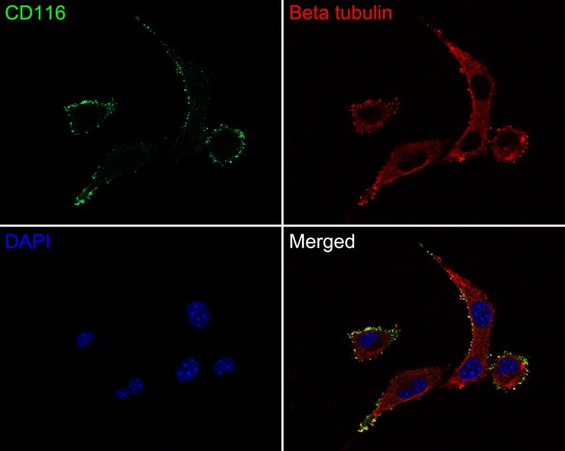 GM-CSFR alpha Antibody (JE61-37)