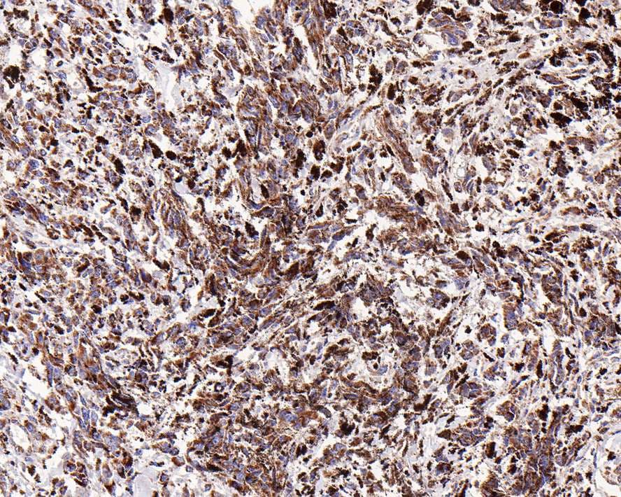 GM-CSFR alpha Antibody (JE61-37)