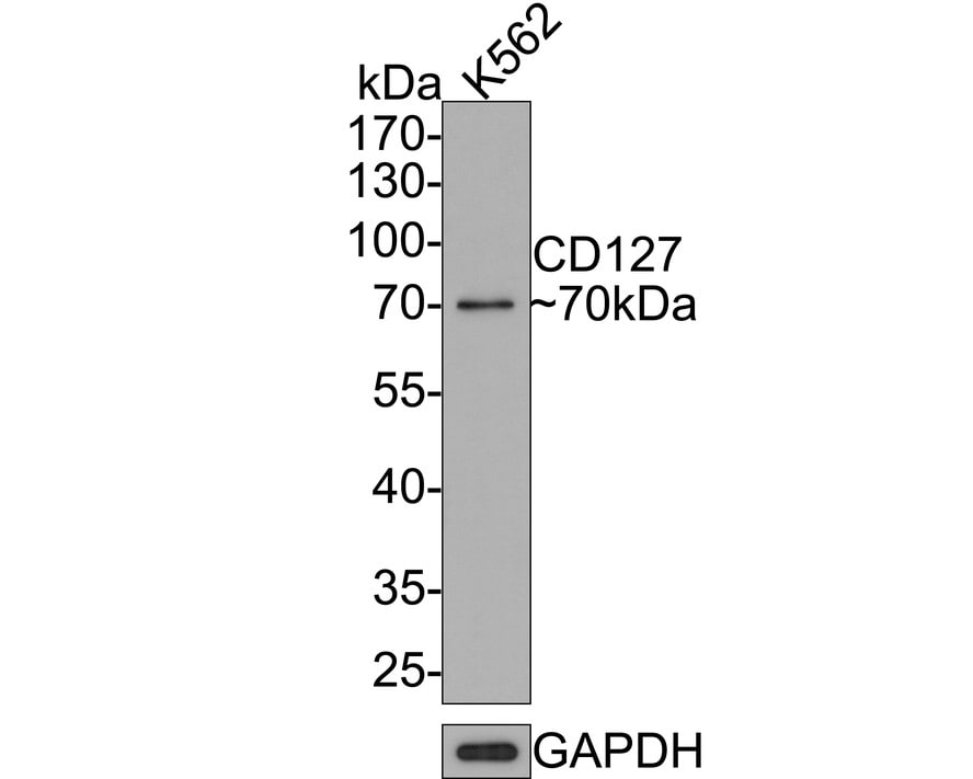 IL-7R alpha/CD127 Antibody (JE37-10) Western Blot: IL-7R alpha/CD127 Antibody (JE37-10) [NBP3-32122]