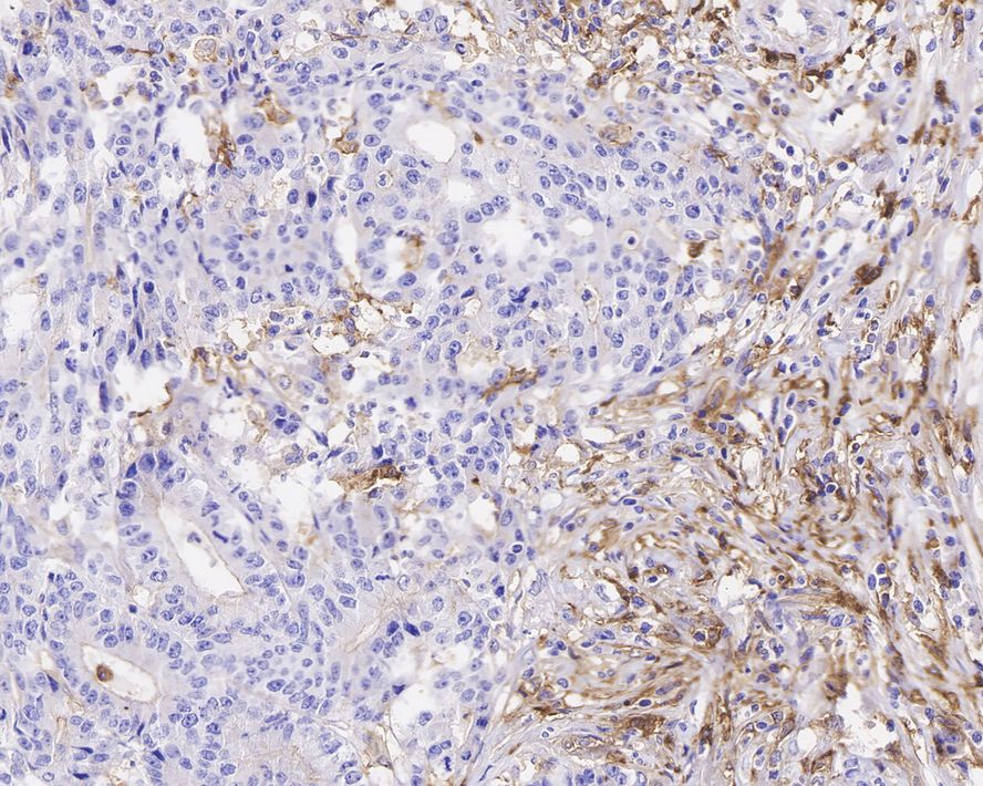 CD14 Antibody (PD01-63)