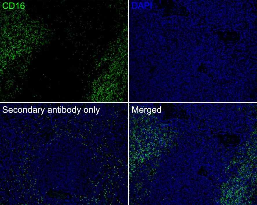 Fc gamma RIII (CD16) Antibody (PD00-12)