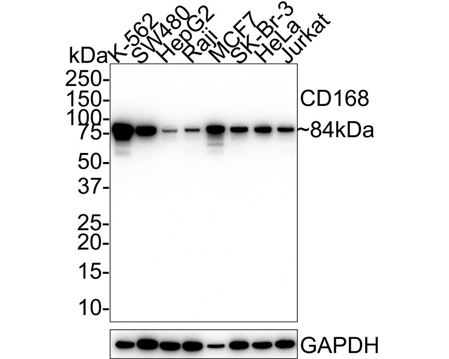 RHAMM/CD168 Antibody (PSH02-16) Western Blot: RHAMM/CD168 Antibody (PSH02-16) [NBP3-32129]