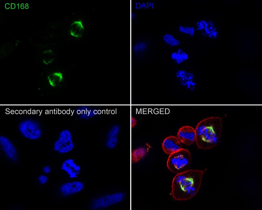 RHAMM/CD168 Antibody (PSH02-16)