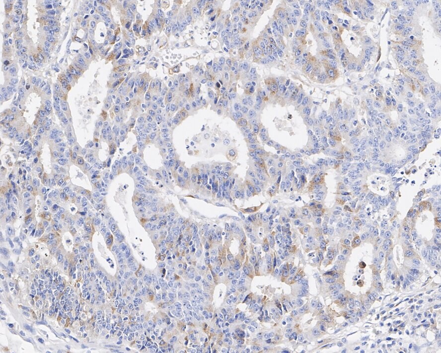 RHAMM/CD168 Antibody (PSH02-16)