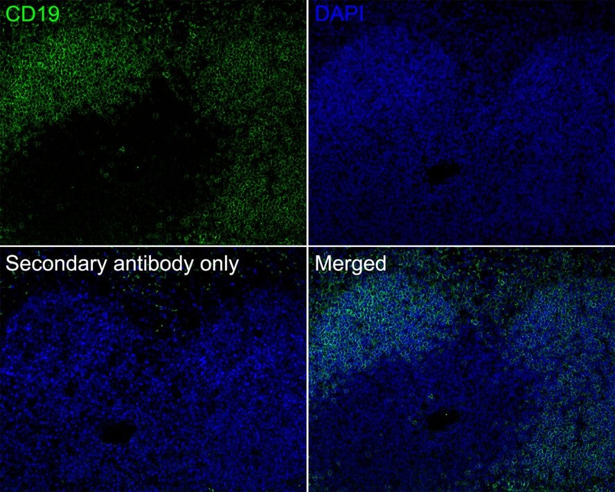 CD19 Antibody (PSH03-94)
