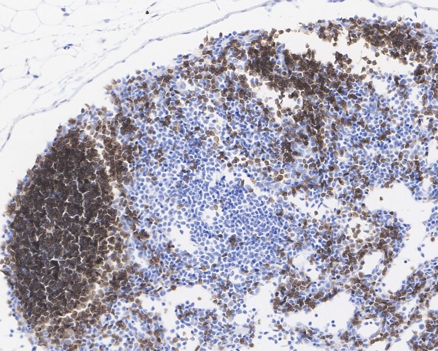 CD19 Antibody (PSH03-94)